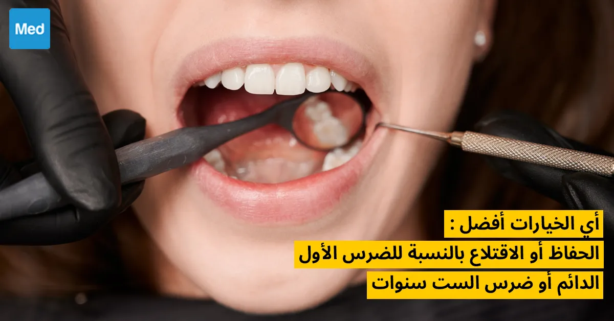 أي الخيارات أفضل : الحفاظ أو الاقتلاع بالنسبة للضرس الأول الدائم أو ضرس الست سنوات
